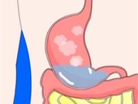 第27讲  肚子饿了为什么会咕咕叫 