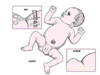 为什么肚子上会有肚脐眼？