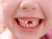 人为什么要换牙？